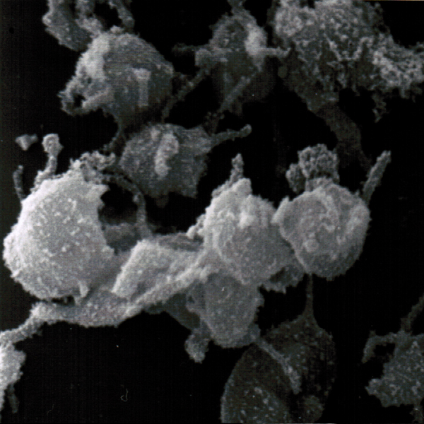 SEM activated platelets in plasma